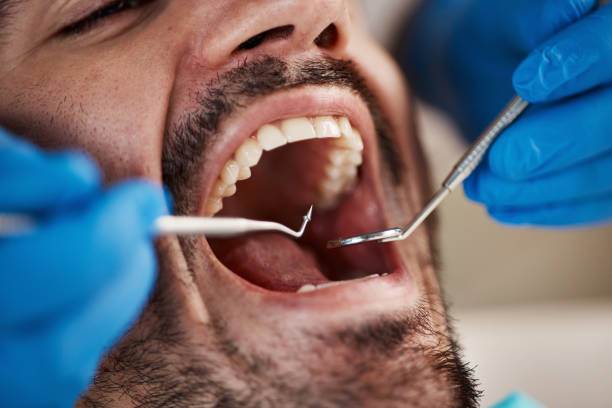Best Broken or Chipped Tooth Repair in Windsor, CO
