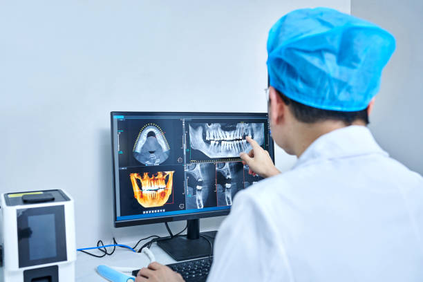 Best Emergency Wisdom Tooth Extraction in Windsor, CO