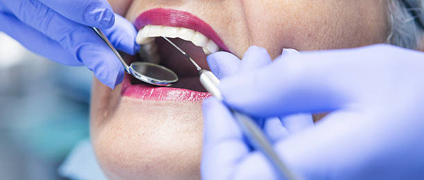 Best Emergency Denture Repair in Windsor, CO